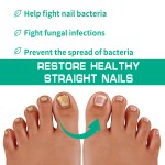 Nails Fungus Cream Manufacturer - Fungal Foot Toe Nails Gel Care