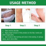Antifungal Spray Manufacturer - Hand Foot Care Medicine Gentle Formula