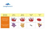 Vertical Autoclave Factory - Digital Display Automation Pressure