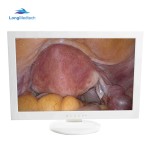 Mammography Machine Manufacturer - Breast Cancer Detection X-ray