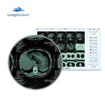 Video Colposcope Factory - Electronic Mobile Digital Medical