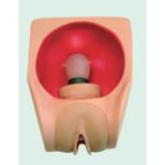 ICU Ventilator Manufacturer - Oxygen Ventilation Respiratory Machine