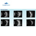 Dynamic Electrocardiograph Manufacturer - 3 Channel 12 Channel Holter