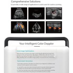 Intestinal Stent Factory - Medical Human Body Implanted Self-Expanding