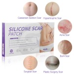 Silicone Scar Patch Factory - Customized Effective Safe