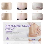 Scar Repair Sheet Manufacturer - 2025 Best Selling
