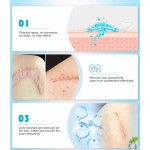 Scar Patches Factory - Thin Comfortable Wound Heal