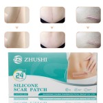 Scar Repair Sheet Manufacturer - 2025 Best Selling