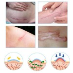 Scar Remedy Patch Factory - Body Effective Patch