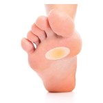 Silicone Scar Sheet Manufacturer - Transparent Stretch Marks Removal