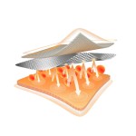 Recovery Manufacturer - Muscle Rehabilitation Aid