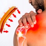 Recovery Manufacturer - Muscle Rehabilitation Aid