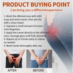 Hemorrhoids Ointment Factory - Best Premium Quality Anus Cleansing