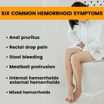 Anal Itching Gel Manufacturer - Factory Direct Sale Hemorrhoids Treatment