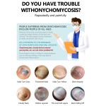 Nail Fungus Kit Manufacturer - Anti-Fungal Brush 30ml Essence