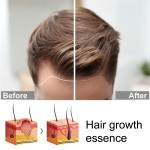 Hair Growth Serum Supplier - 7 Days Anti Loss Repair Care