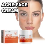 Acne Removal Cream Supplier - Herbal Oil Control BHA Salicylic