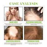 Ginger Shampoo Manufacturer - Low MOQ Deep Cleansing Nourishing