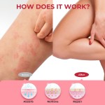 Psoriasis Cream Manufacturer - Dermatitis Eczema Herbal Ointment