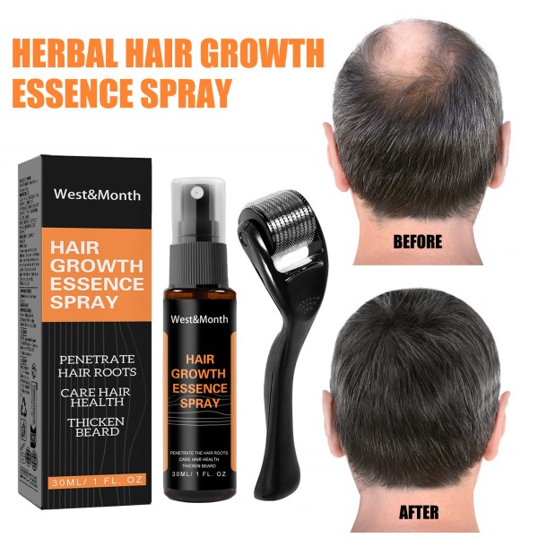 Hair Growth Spray Manufacturer - Polygonum Ginseng Ginger Fast