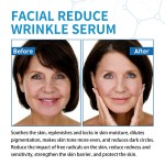 HYALU B5 Serum Factory - Anti Aging Wrinkle Reducing