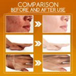 Orange Peel Lotion Manufacturer - Mild Exfoliates Lightens Spots