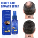 Herbal Spray Supplier - Essential Oil Ginger Regrowth