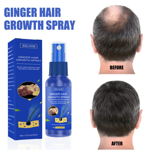 Herbal Spray Supplier - Essential Oil Ginger Regrowth