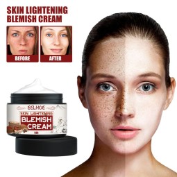 Blemish Cream Factory - Hot Sale Fade Freckles Whitening