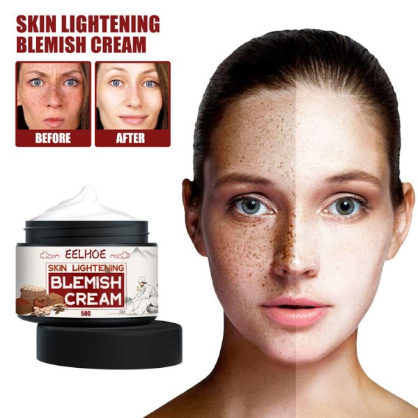 Blemish Cream Factory - Hot Sale Fade Freckles Whitening