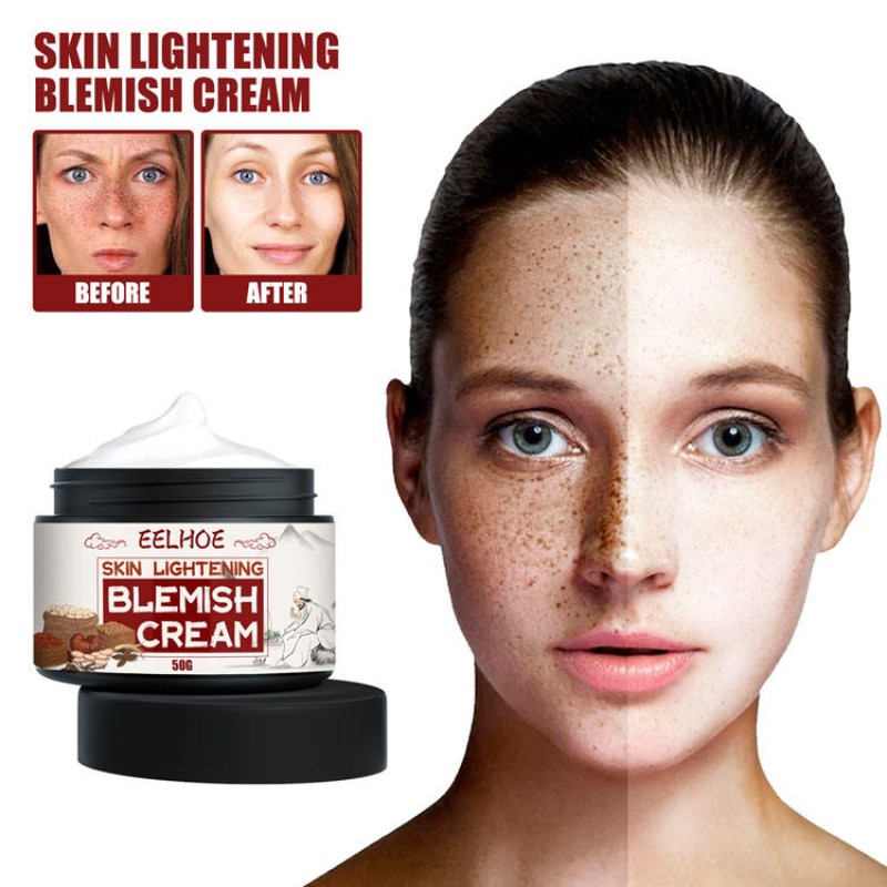 Blemish Cream Factory - Hot Sale Fade Freckles Whitening
