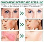 Color Correcting Cream Manufacturer - Natural Organic Salicylic Acid