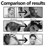 Hair Root Spray Factory - Anti Loss Strong Anti-Drying Care