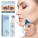 Hyaluronic Acid Liquid Manufacturer - Moisturizing Anti-wrinkle Repair