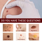 Warts Remover Manufacturer - Private Label Skin Tags Gel