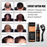 Hair Growth Spray Manufacturer - Polygonum Ginseng Ginger Fast