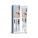 Psoriasis Ointment Supplier - 20g Acne Dermatitis Eczema