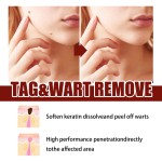 Warts Remover Manufacturer - Private Label Skin Tags Gel