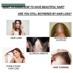 Hair Growth Serum Supplier - 7 Days Anti Loss Repair Care