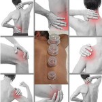 Silicone Cupping Set Factory - Best Selling Transparent for Self-treatment