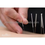Silver Handle Acupuncture Needles Manufacturer - High Quality for Medical