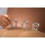 Medical Cupping Glass Supplier - Vacuum Cupping Therapy OEM