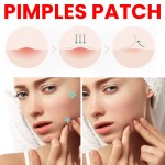 Pimple Patches Factory - Fast Acting Pus Absorption Swelling
