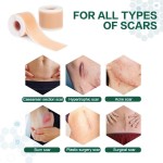 Silicone Scar Sheets Factory - Old New Scars Surgery Burn