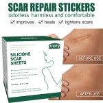 Silicone Gel Scar Patch Factory - Reusable C Section Surgery