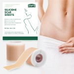 Silicone Gel Scar Patch Factory - Reusable C Section Surgery