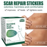 C Section Scar Patch Manufacturer - Soft Silicone Postpartum Recovery