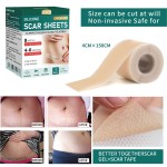 Scar Removal Patches Supplier - Medical Grade Redness Smoothing