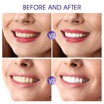 Teeth Whitening Pen Manufacturer - Tooth Whiteness Cleaning Kit