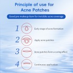 Acne Patches for Face Manufacturer - Extra Adhesion Natural Plant Ingredients
